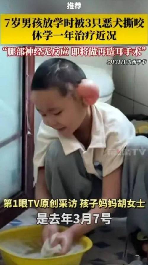 2025新澳门天天开奖攻略和7岁男孩遭3只犬撕咬与7岁男孩遭3只犬撕咬怎么办